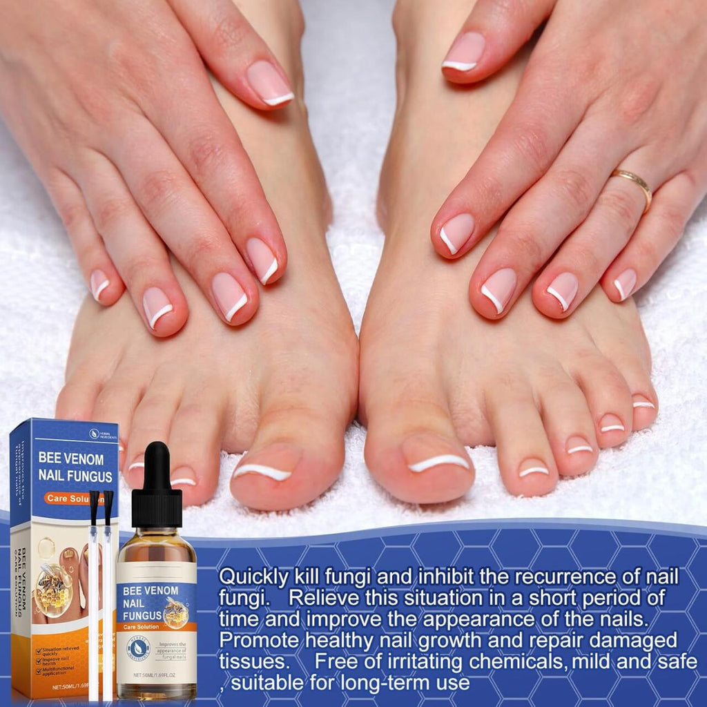 Sérum para Uñas con Veneno de Abeja 50ml – Tratamiento Antihongos y Cuidado Intensivo